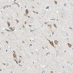 SLC6A15 Antibody, Novus Biologicals 0.1mL; Unlabeled:Antibodies, Polyclonal